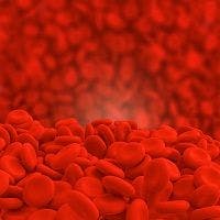 Promising New Therapy for Iron Deficiency Anemia in IBD Patients