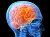 Training Improves Cognitive Function for Brain Injury Patients