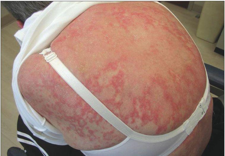 Rash Questions for Rheumatologists