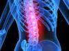 New Treatment Seeks to Relieve Pain Caused by Lumbar Spinal Stenosis 