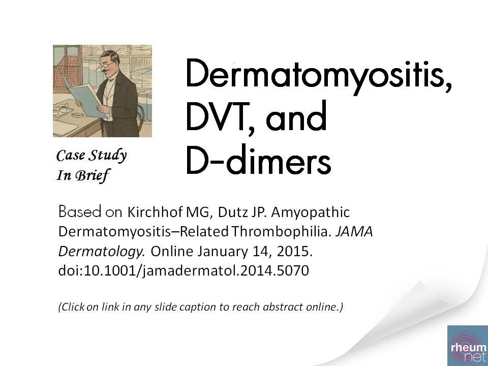 Dermatomyositis, DVT, and D-Dimer