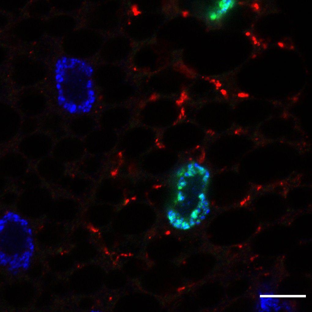 Scientists Discover Proteins That Determine How Cells Respond to Fasting