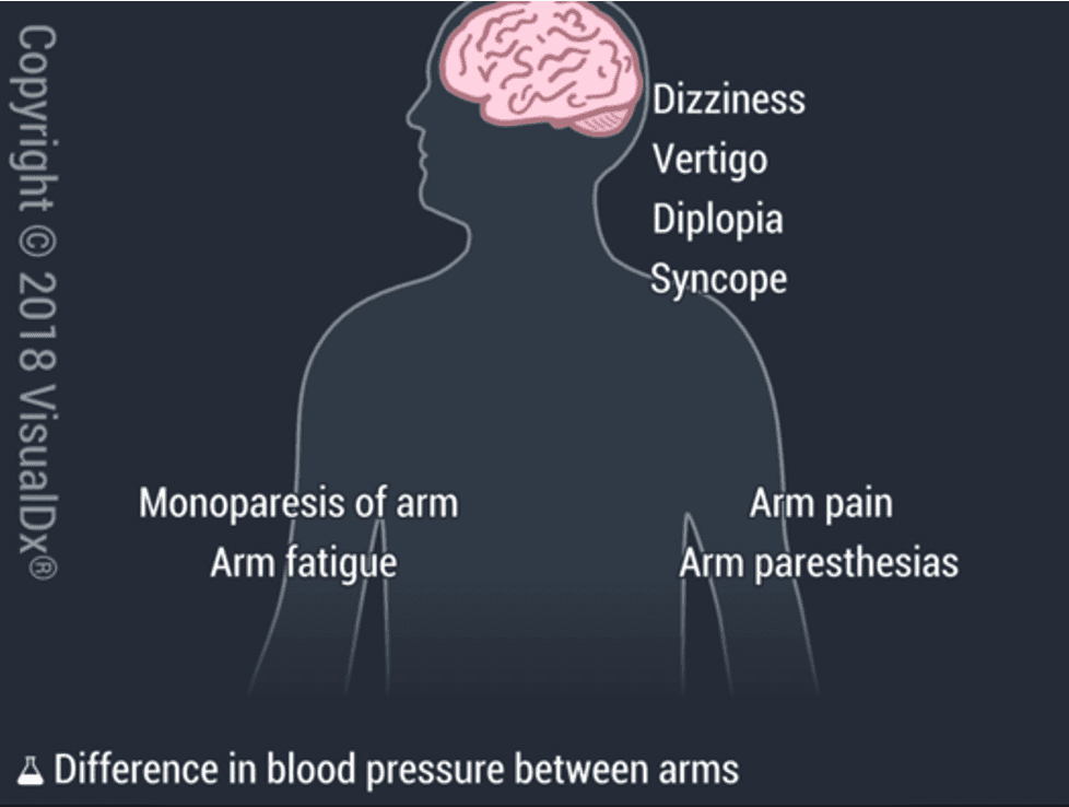 Image IQ: Older Patient with Hypertension Experiencing Numbness in Left Arm