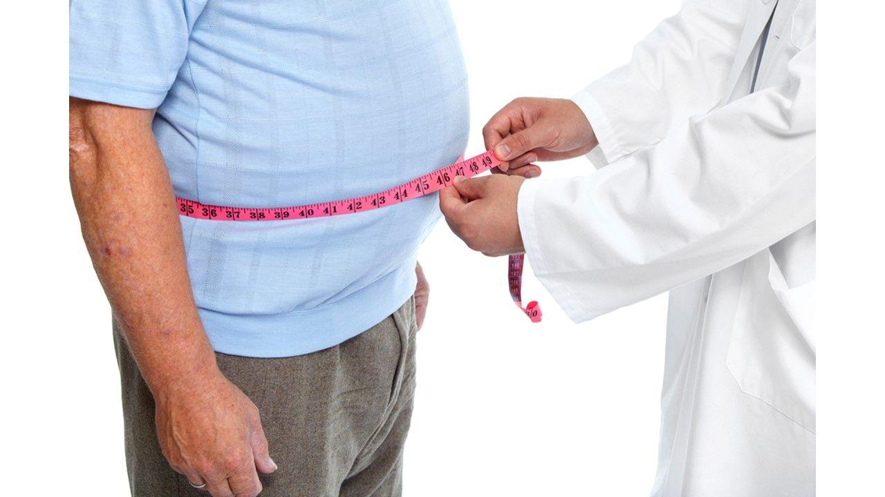 Obesity as disease or not?