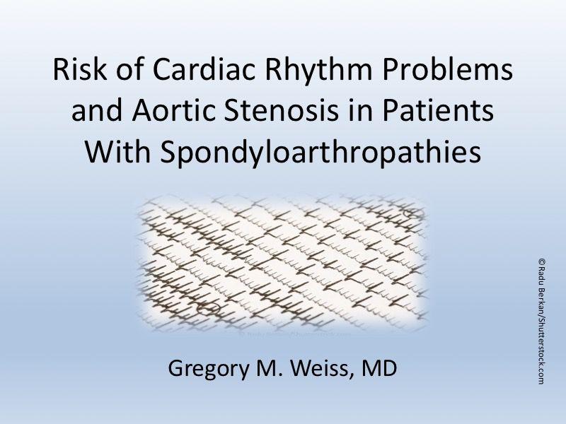 Risk of Cardiac Disease in Patients With Spondyloarthropathies