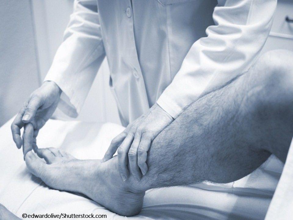 10 Questions About Gout: A Quiz