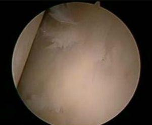 Through the Arthroscope: An Orthopedic Surgeon’s View