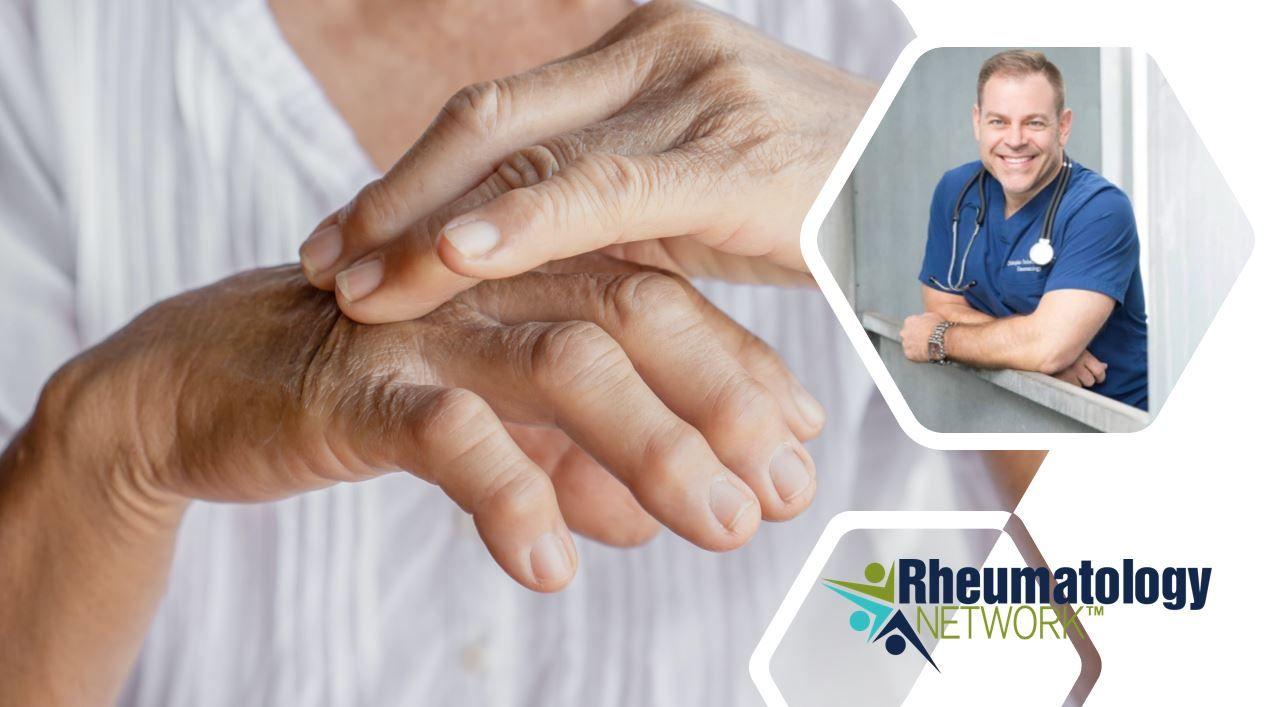 Treatment Choices:  Rheumatoid Arthritis Case Study