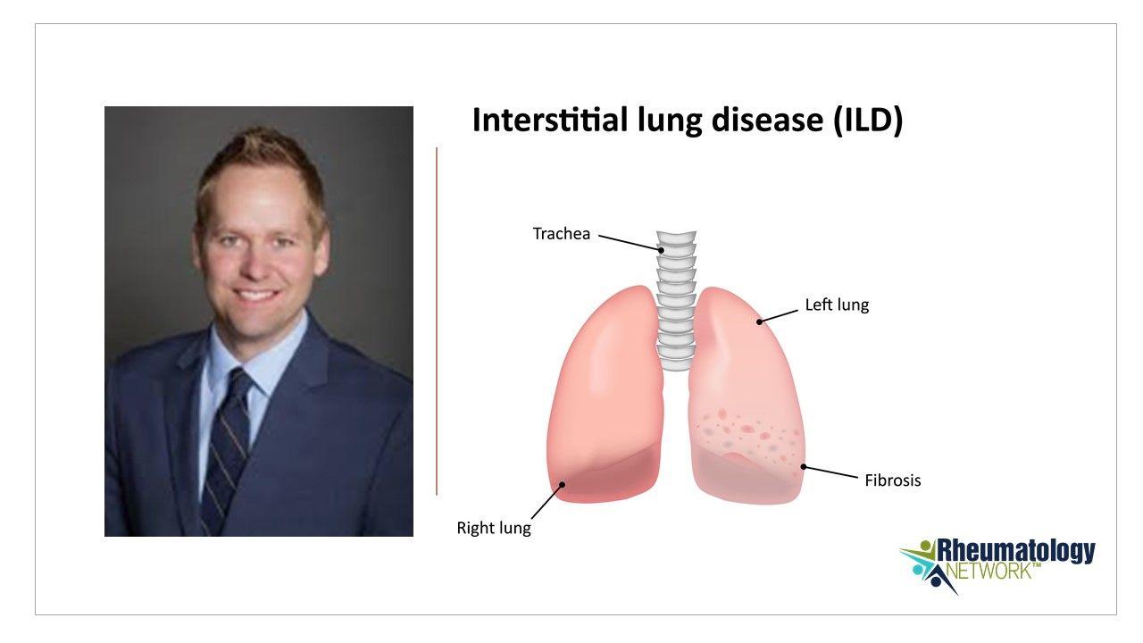 Interdisciplinary Medicine Is Best in Rheumatology