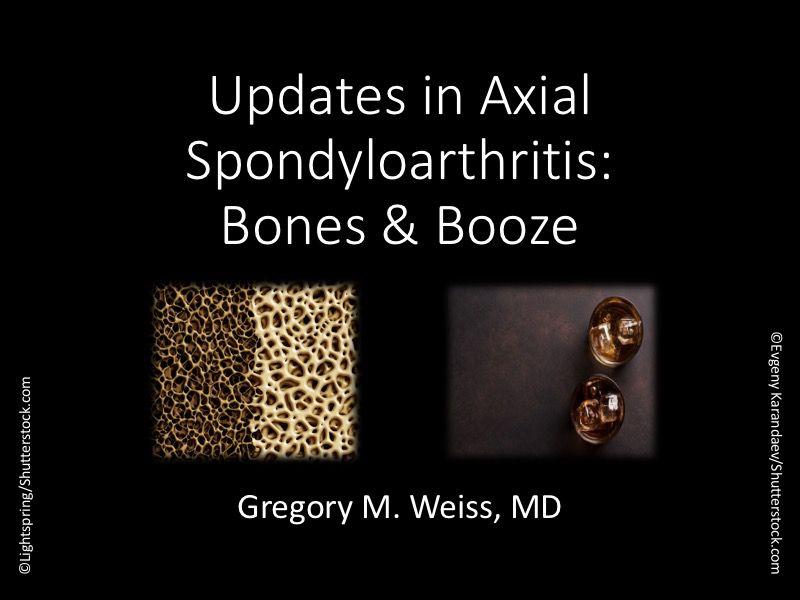 Updates in Axial Spondyloarthritis: Bones and Booze