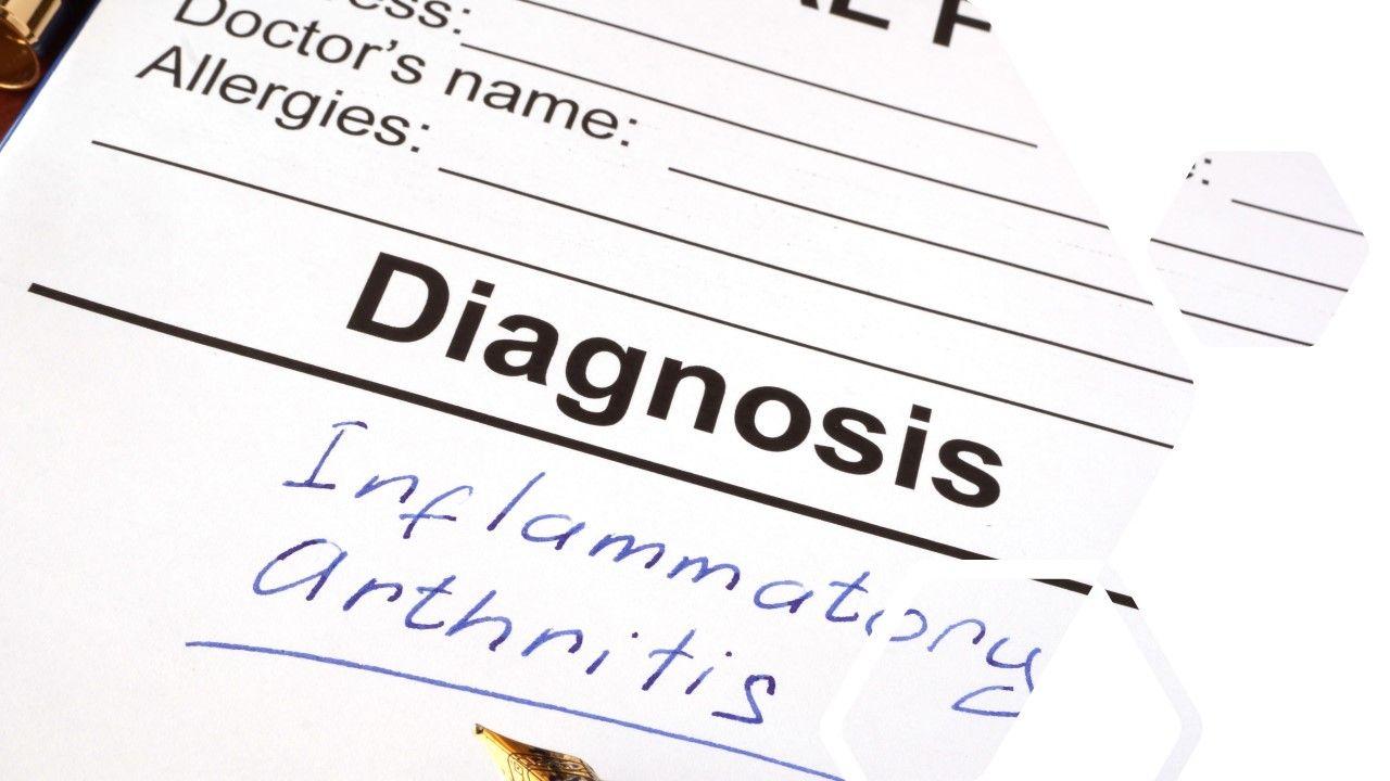 11 Considerations for Tapering Biologic Therapy in Inflammatory Arthritis