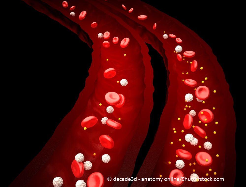 Lupus Leads Inflammatory Disorders in Cardiometabolic Risk