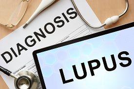 Lupus (©Designer491/Shutterstock.com)