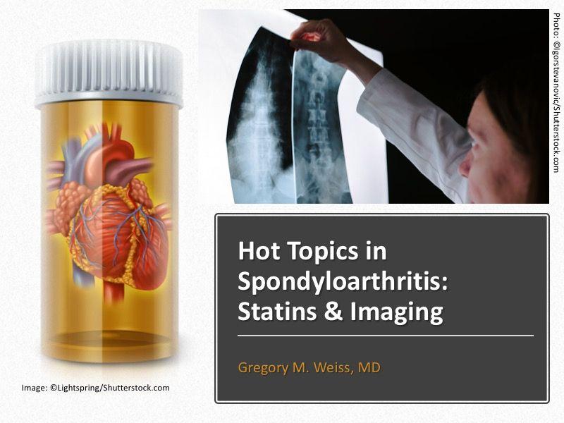 Hot Topics in Spondyloarthritis: Statins & Imaging