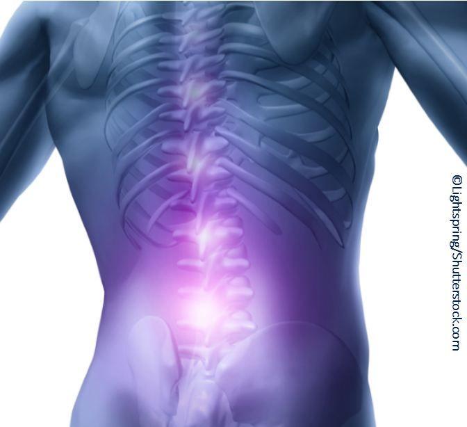 Low Back Pain: A Short Quiz