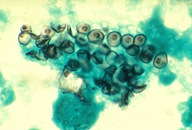 Pneumocystis carinii