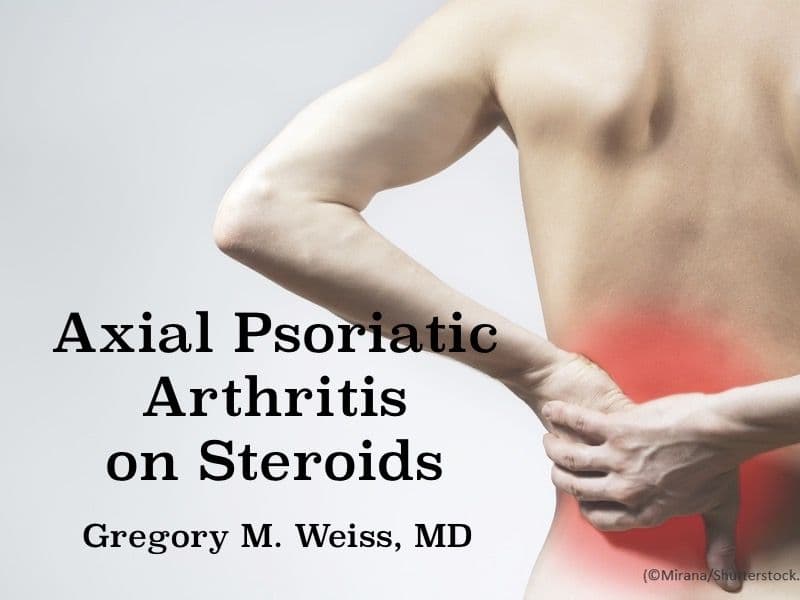 Axial Psoriatic Arthritis and Corticosteroids