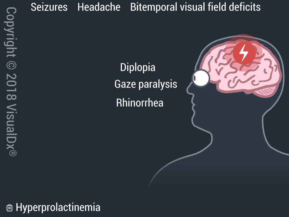 Image IQ: Rhinorrhea and Vision Loss