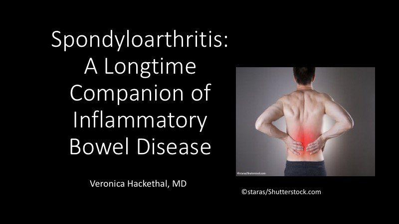 Spondyloarthritis: A Longtime Companion of Inflammatory Bowel Disease