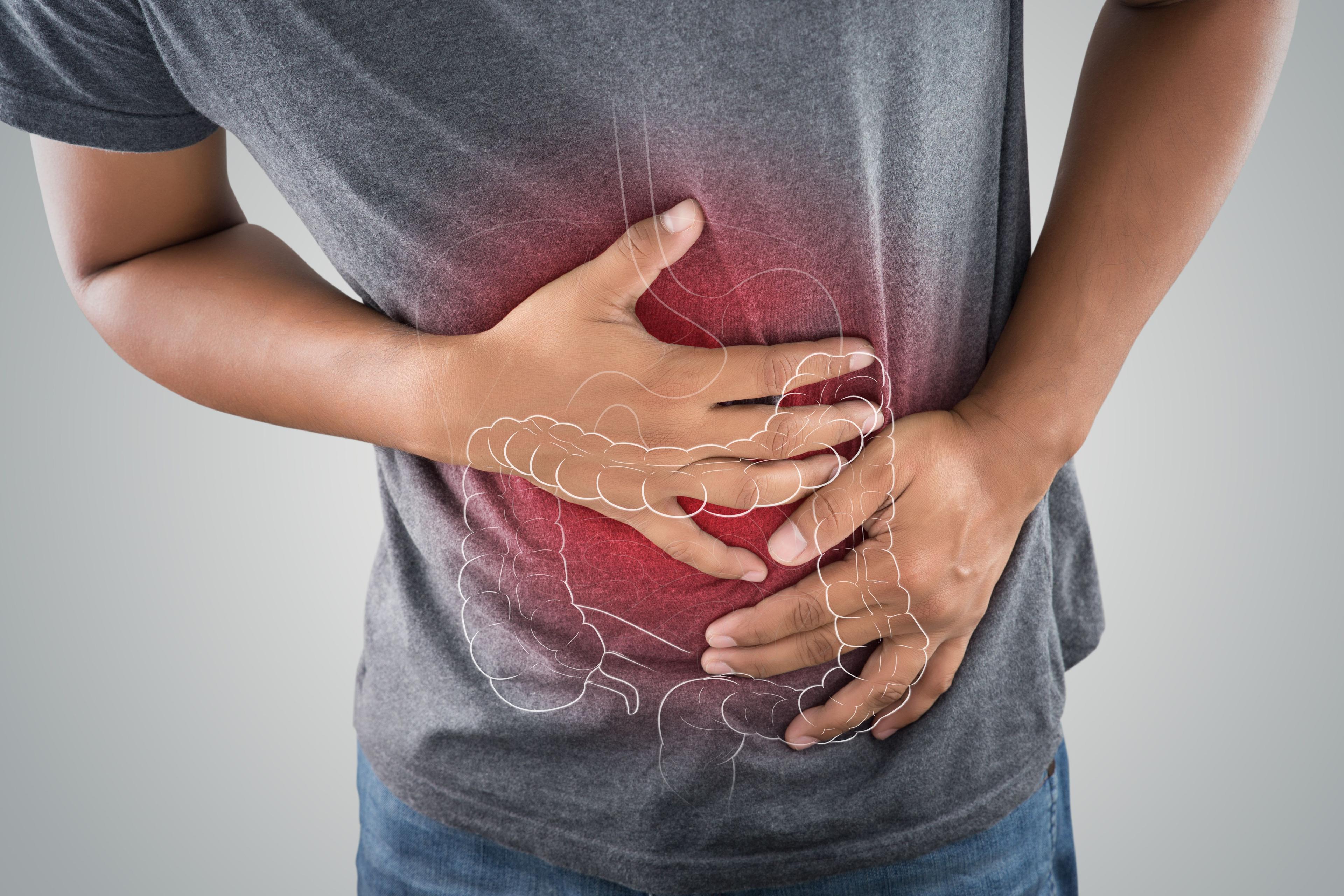 Upadacitinib Achieved Primary Endpoints in Crohn’s Disease Study