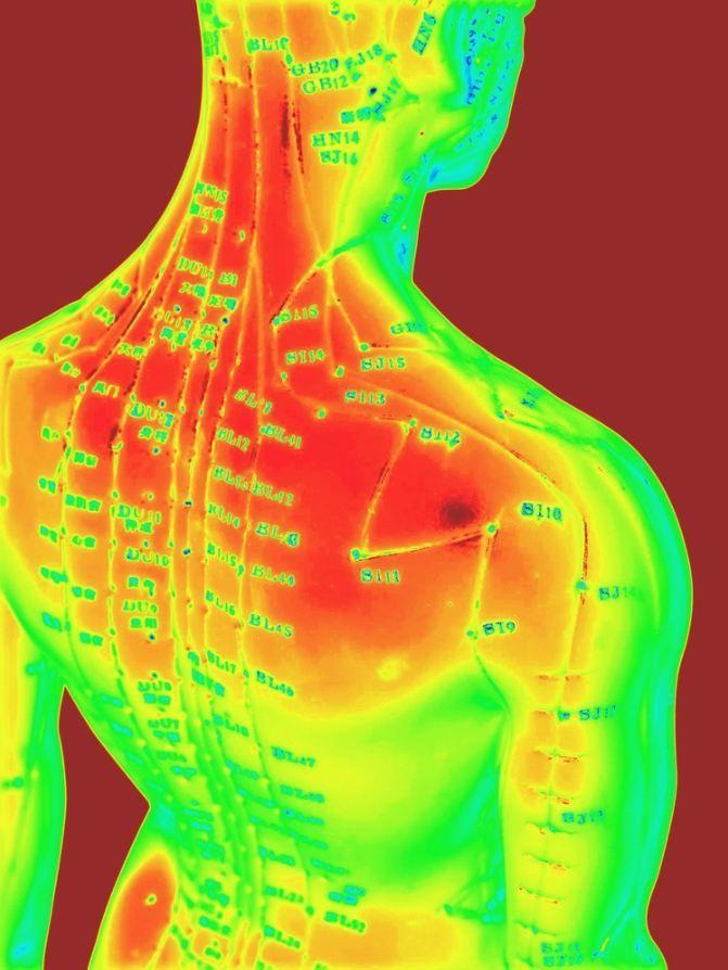 A Pointed Debate on Acupuncture for Chronic Pain