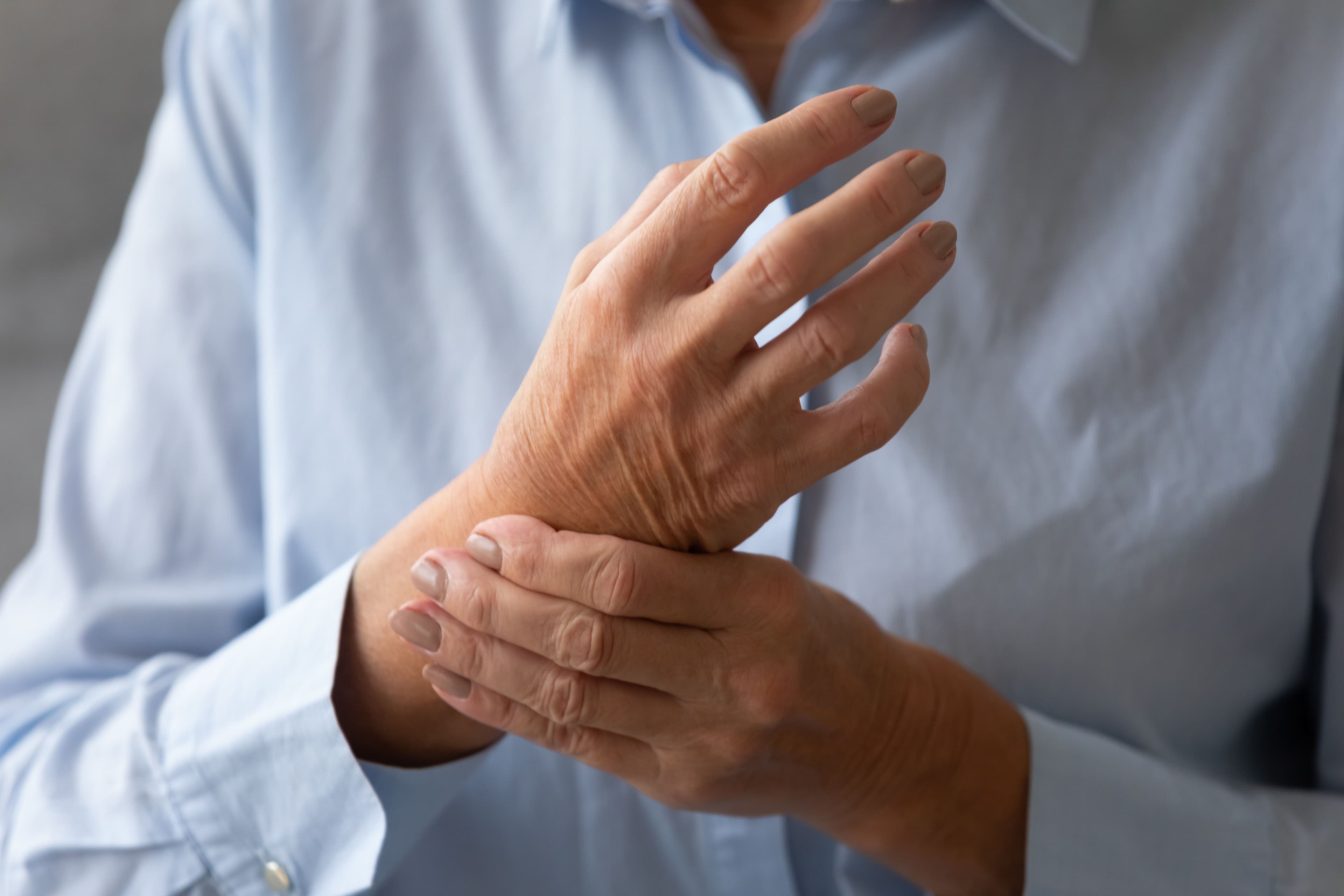 Rheumatoid arthritis quiz