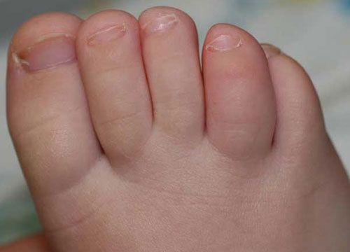 PhotoQuiz: Footnotes in Differential Diagnosis