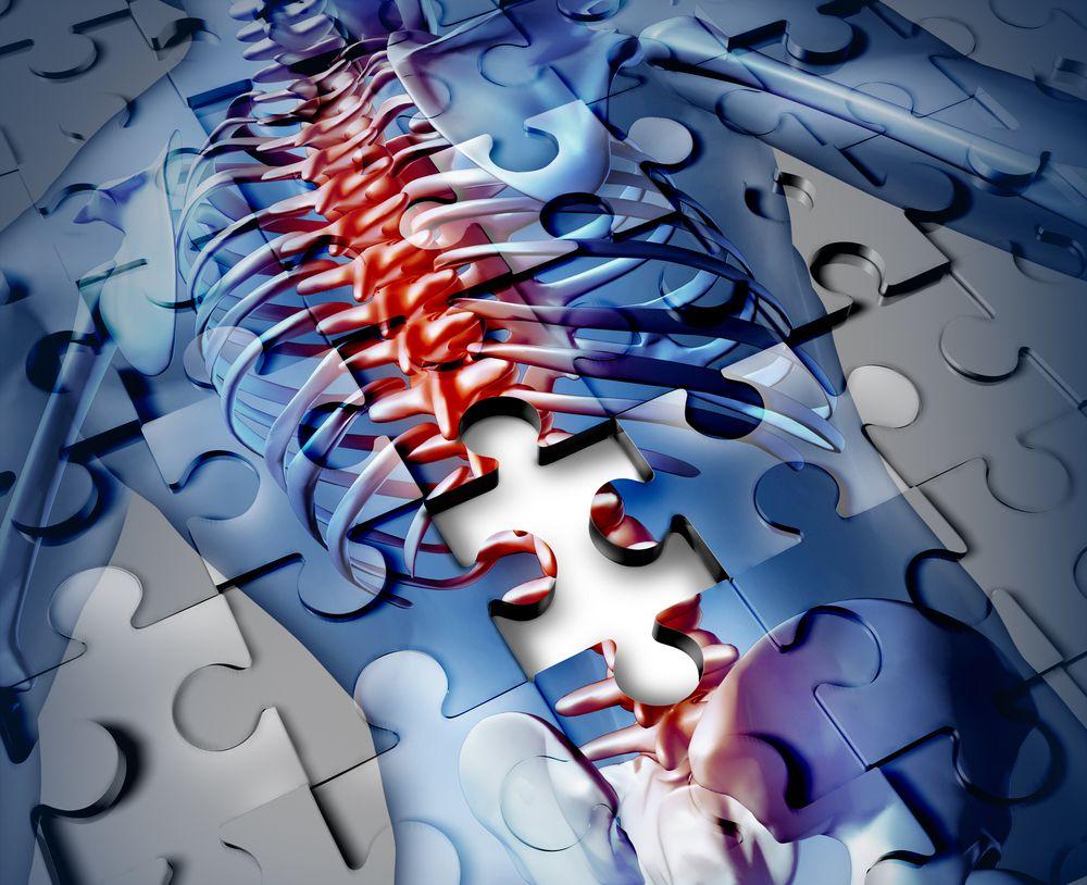 Axial Spondyloarthritis Treatment Recommendations