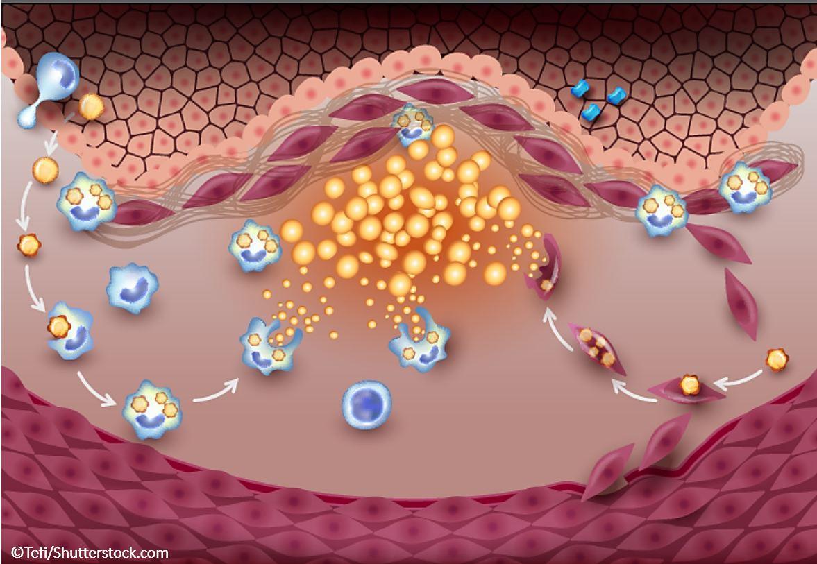 cardiovascular outcome trials, diabetes, cardiology, ASCVD 