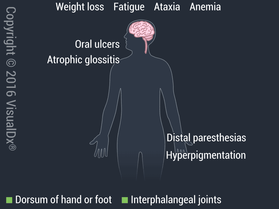 Image IQ: Depression, Tingling and Numbness