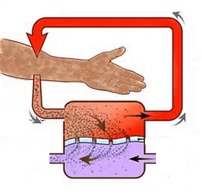 lupus nephritis