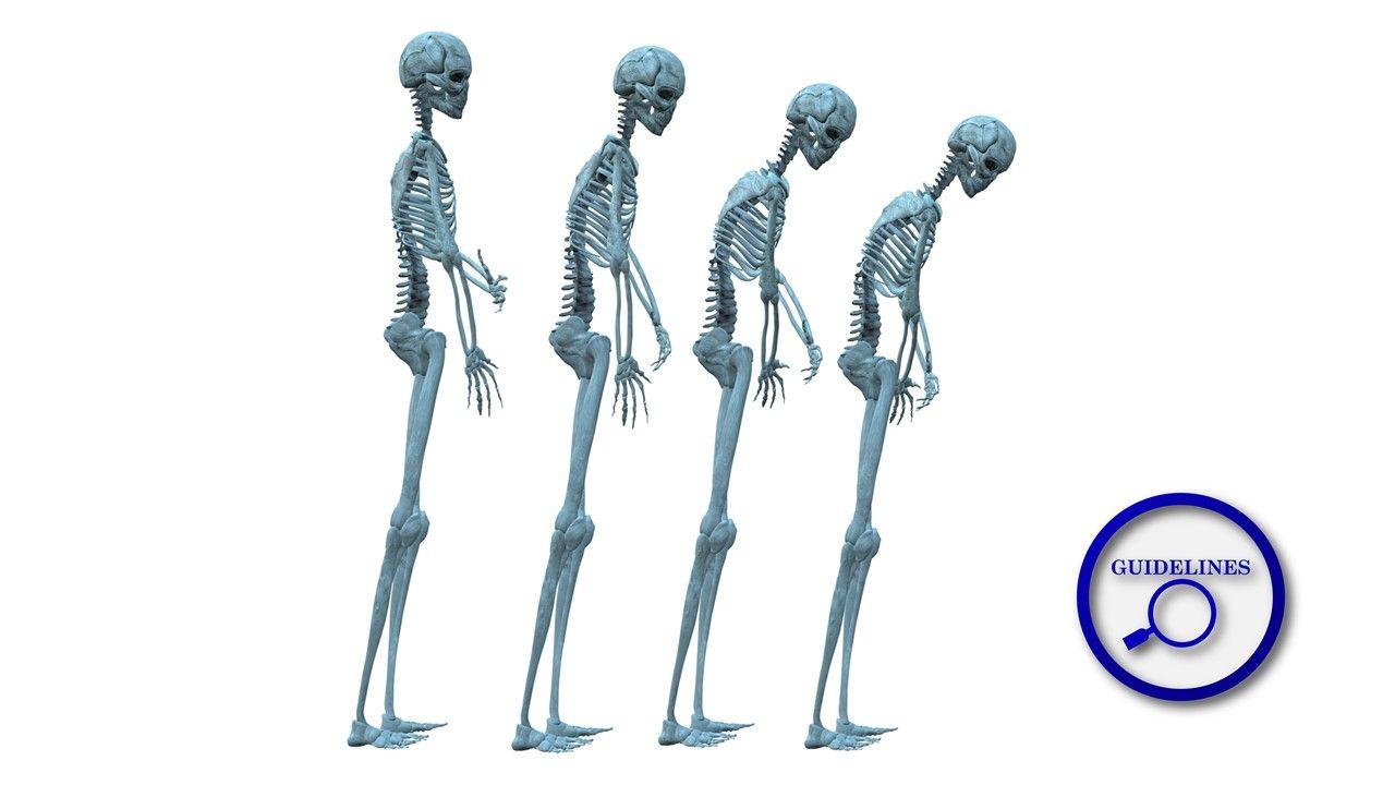 New Osteoporosis Guidelines Support Multi-Disciplinary Treatment