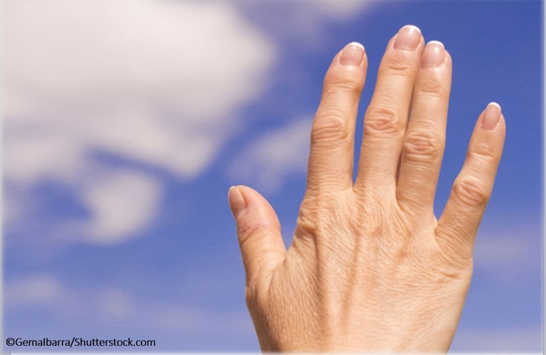 How Well Do You Know Practice Recommendations for Psoriatic Arthritis?