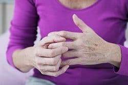 Hand Osteoarthritis Is a Lifetime Risk