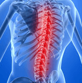 spondyloarthritis