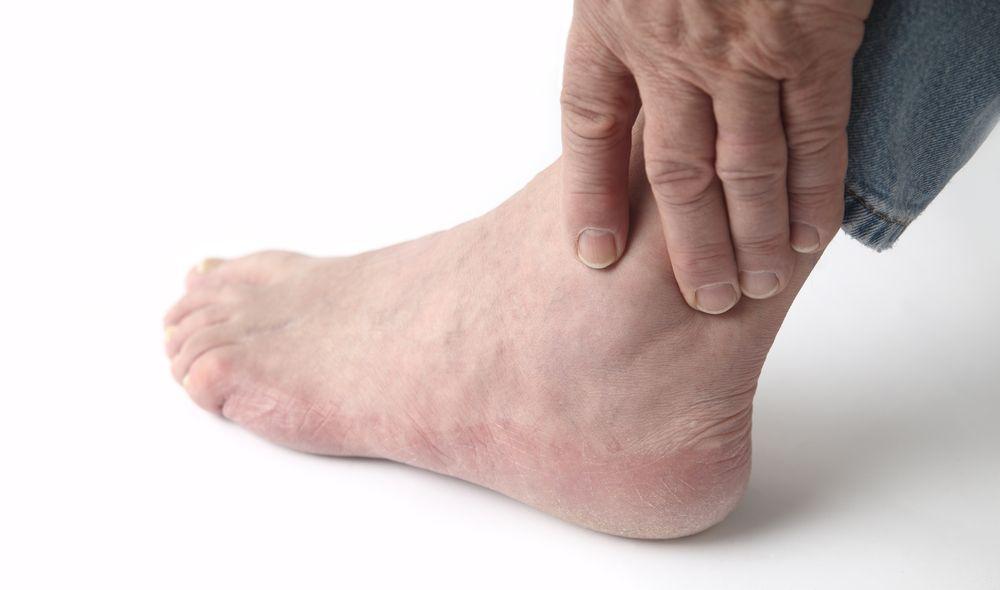 Ankle (©AliceDay/Shutterstock.com)