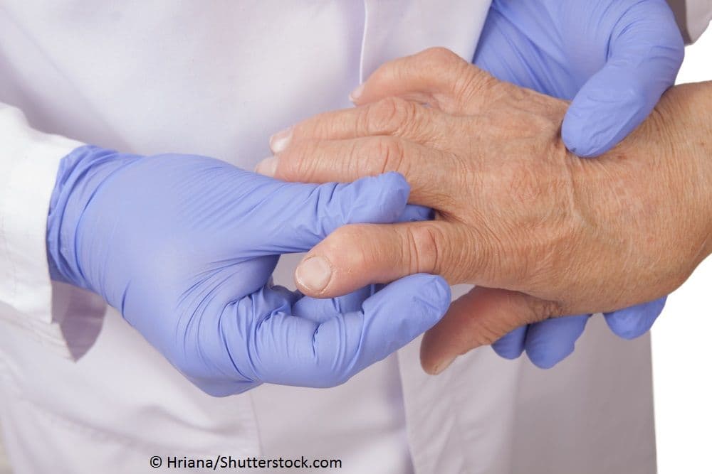 Rheumatoid Arthritis Prediction Helps Prevention 