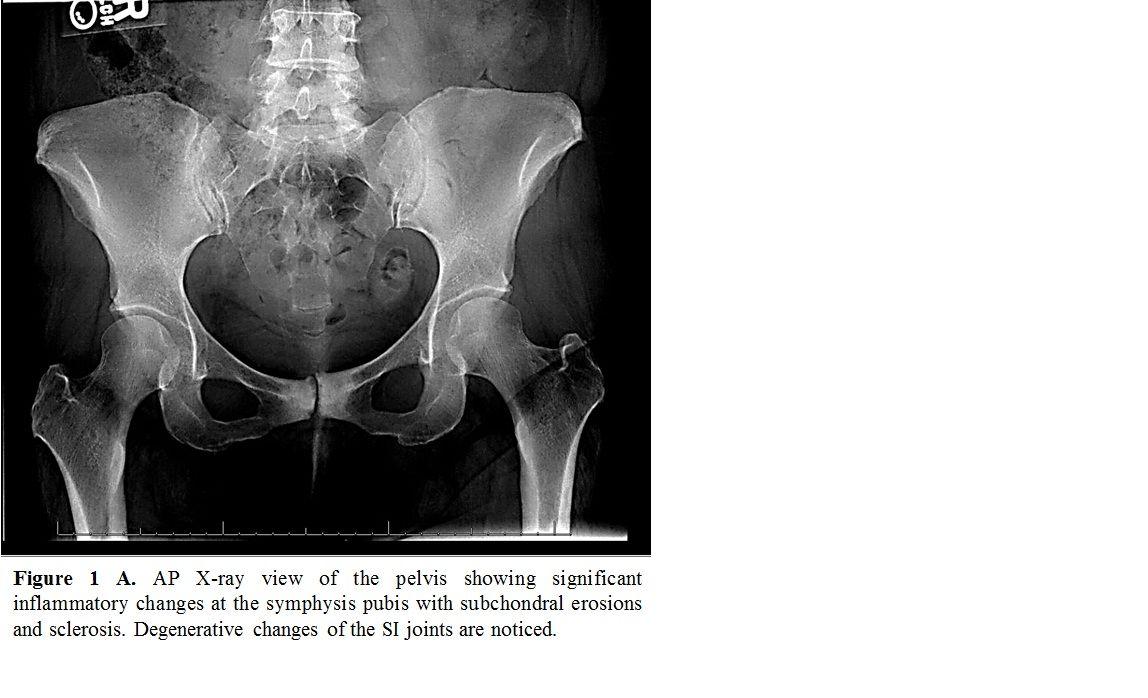 Figure 1 ©Rajai Nammas