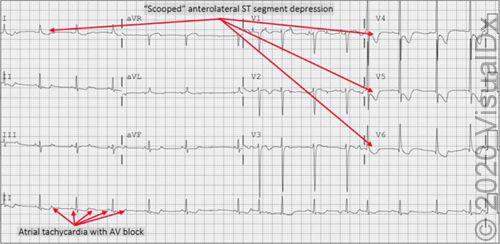 Image IQ: 78-Year-Old Presenting with Confusion, Recent Vomiting