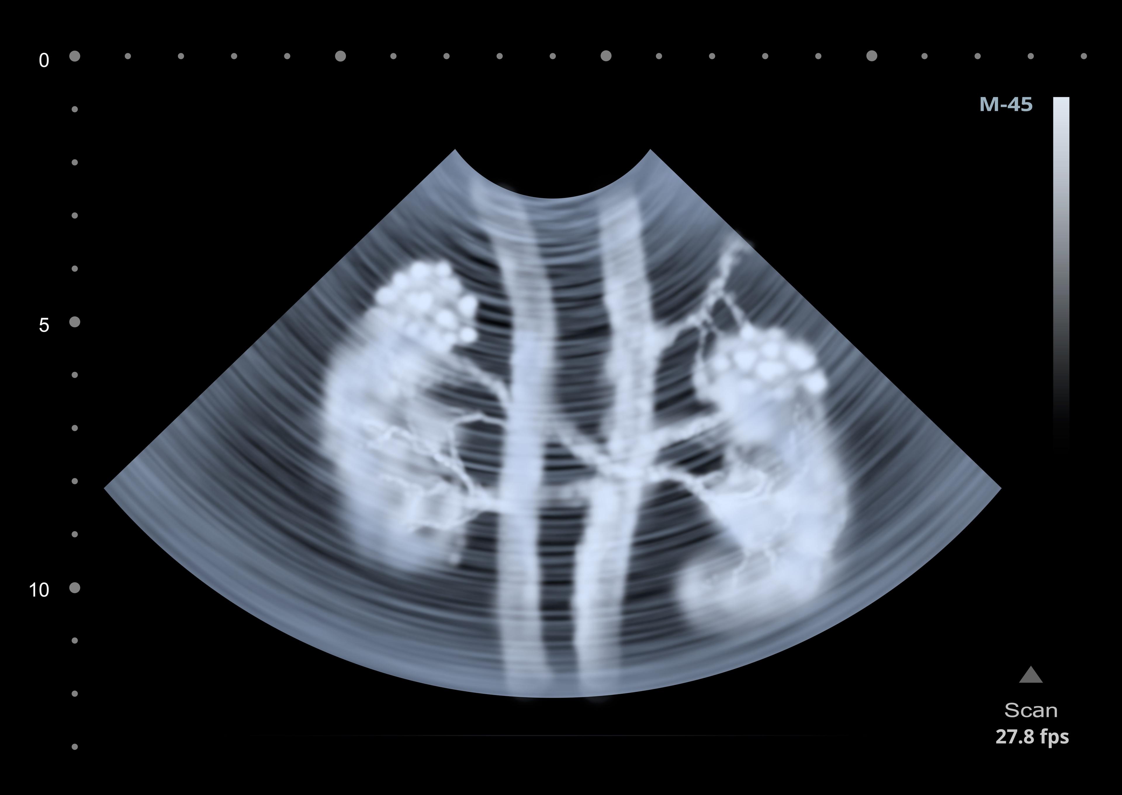 9 Lupus Nephritis Studies that Should be on Your Radar