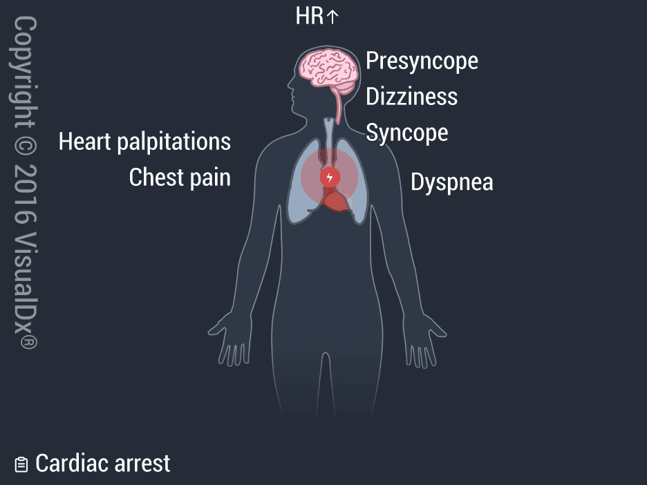 Image IQ: 42-year-old man with dizziness and racing heartbeat