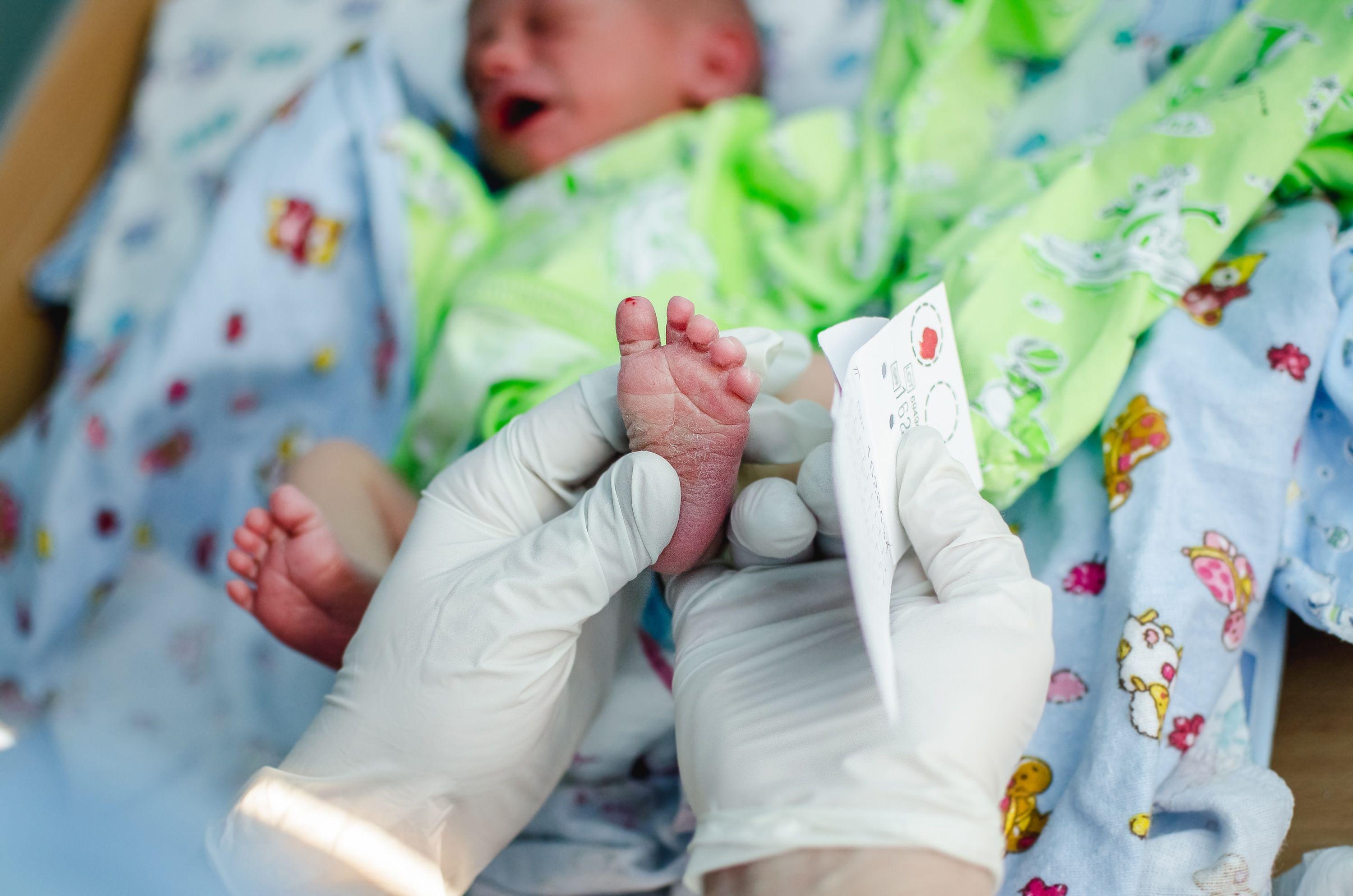 Infant's First Stool Could Inform Risk of Obesity Later in Life