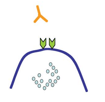 Can ACPA Predict Long-Term Remission in RA?