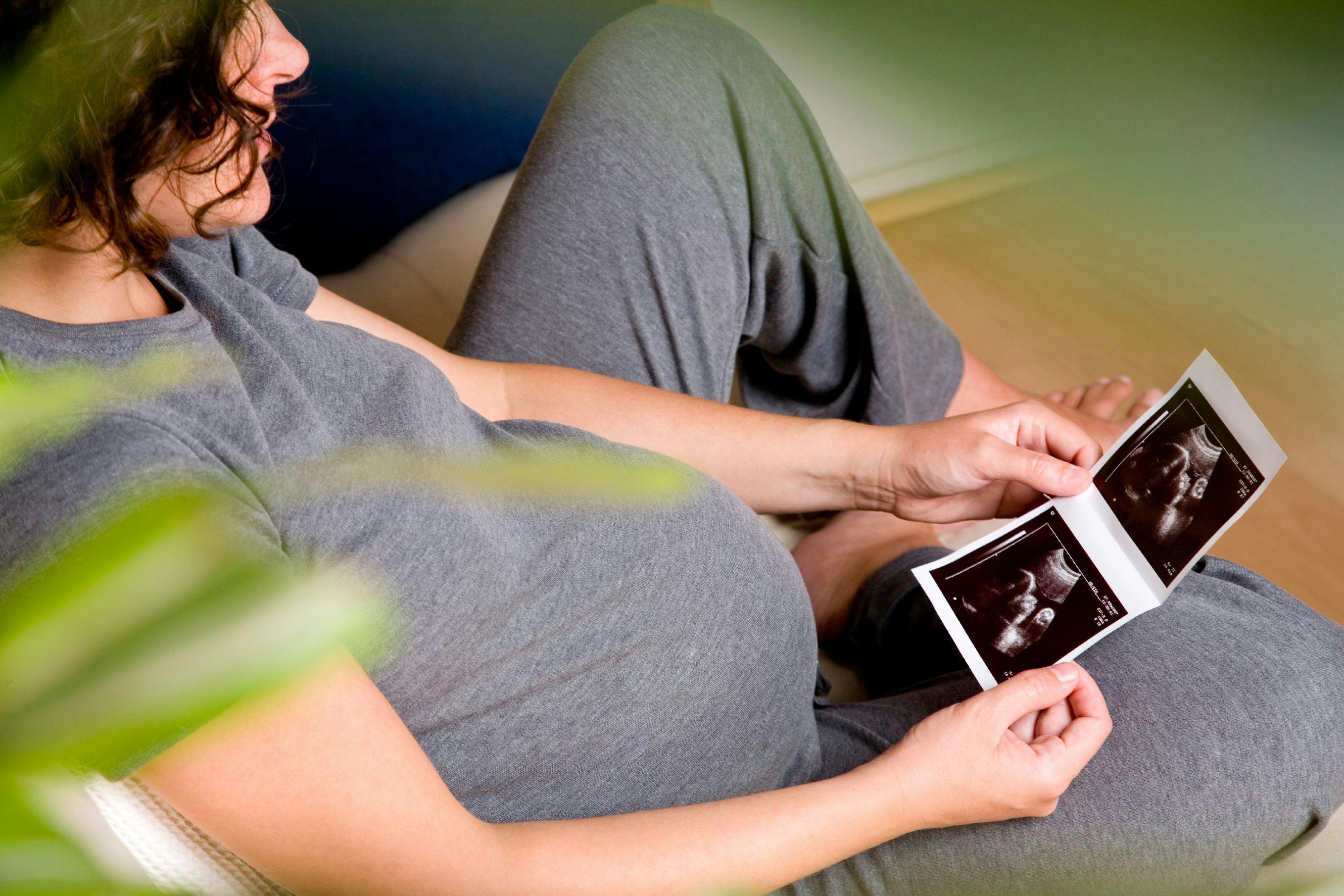 Collaborative Care Approach Could Improve Care for Pregnant Women with CVD