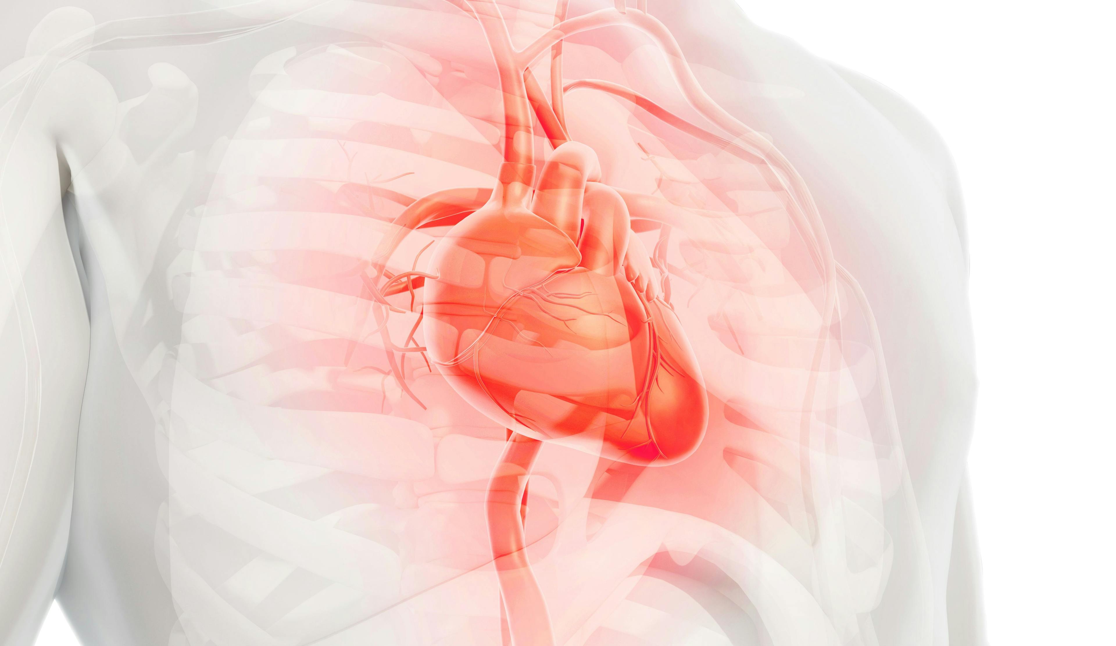 SCAI Releases Updated Shock Classification Statement