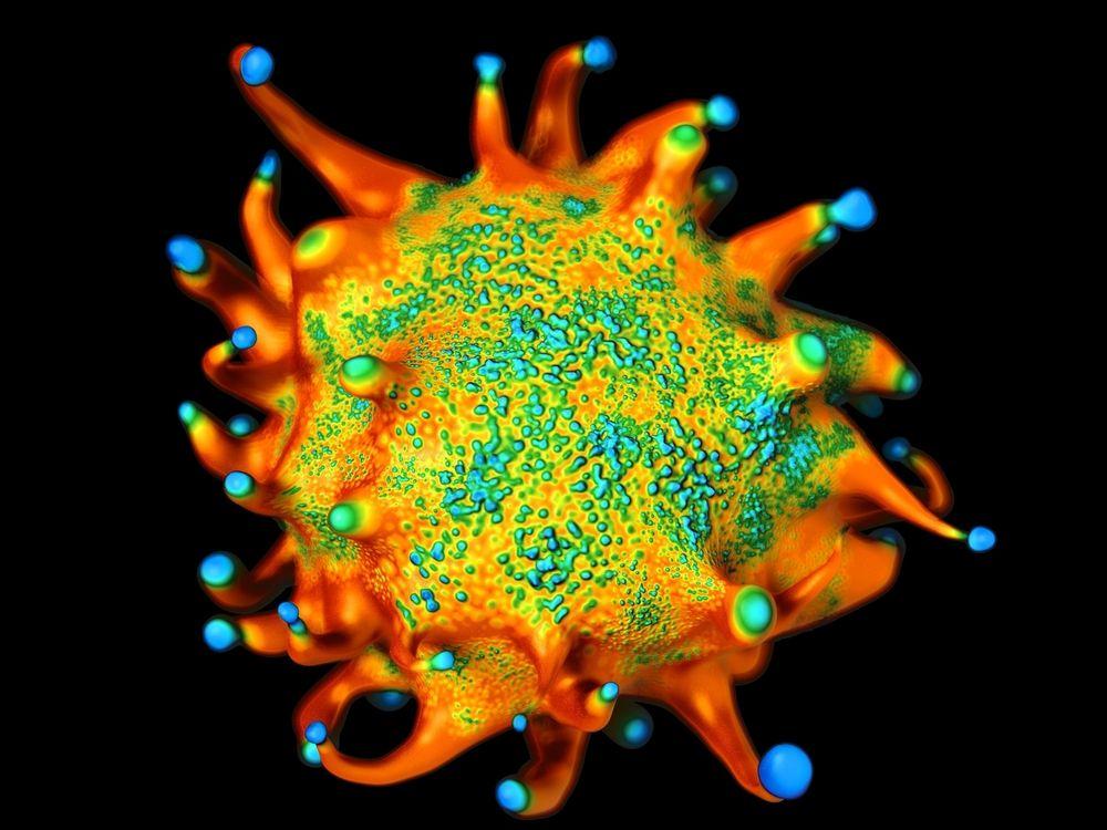 Lymphoma cancer cell (©Royaltystockphoto/Shutterstock.com)