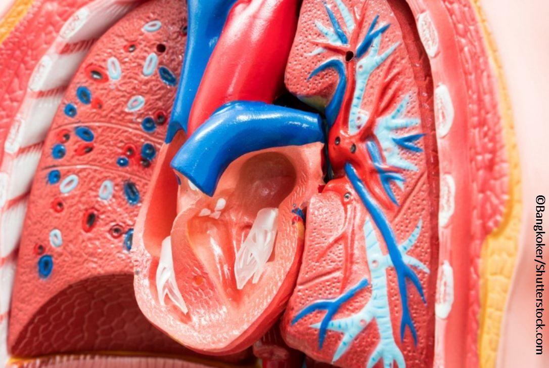 PAH Associated with SLE: A Step Toward a Clinical Profile 