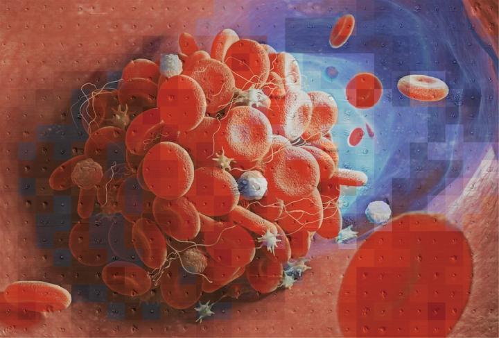 Mosaic of a blood clot created using the numerous platelet images