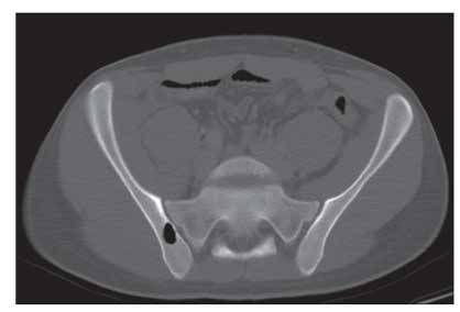 Abdominal Pain, Vomiting, and Nausea in a 17-Year-Old Patient