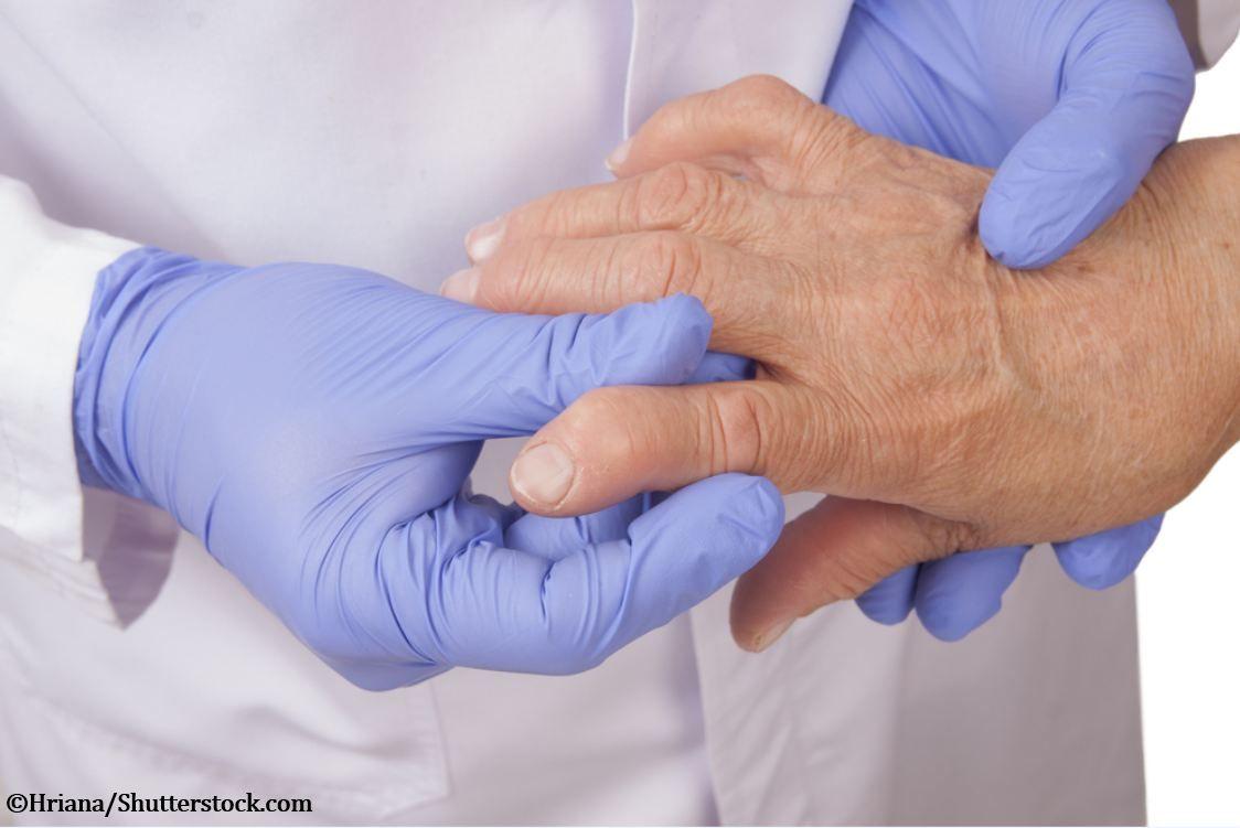 Ultrasound vs MRI for Detecting Synovitis in Rheumatoid Arthritis